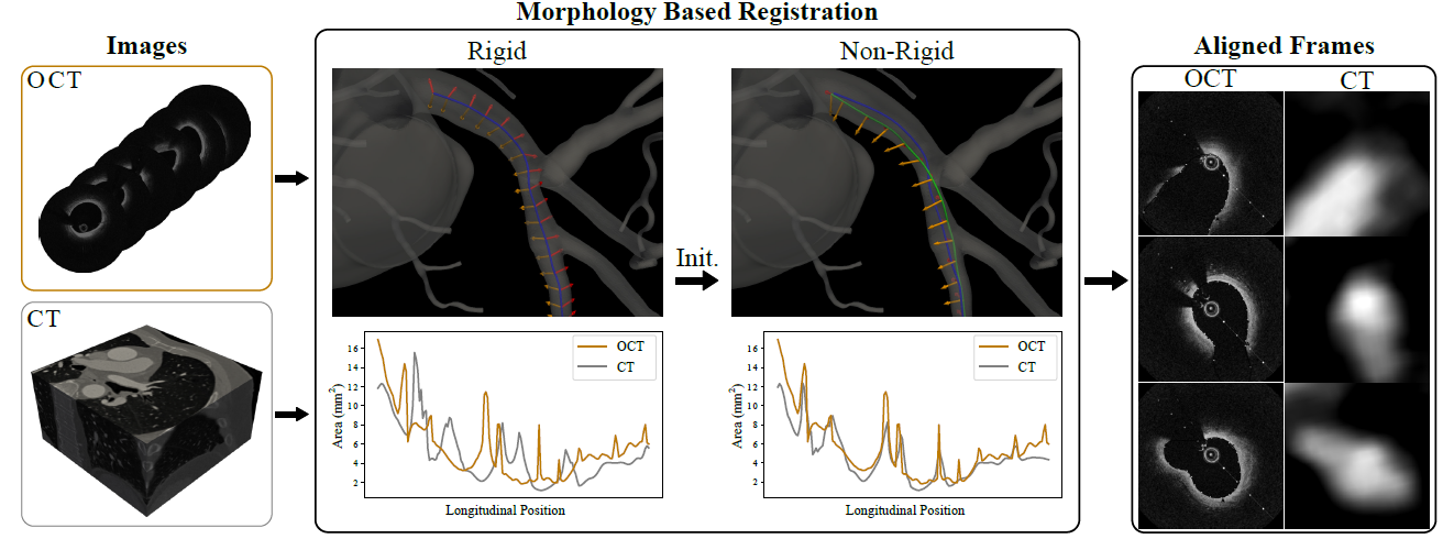 morphology_non_rigid_registration.html